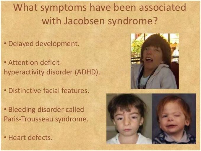 These are the symptoms of Jacobsen syndrome