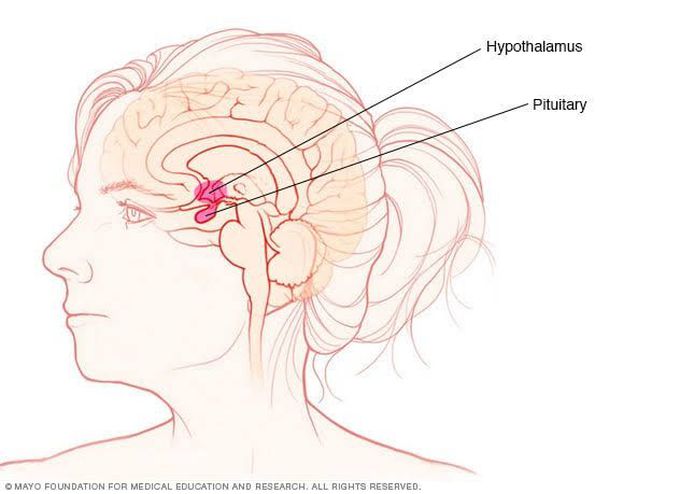 Galactorrhea