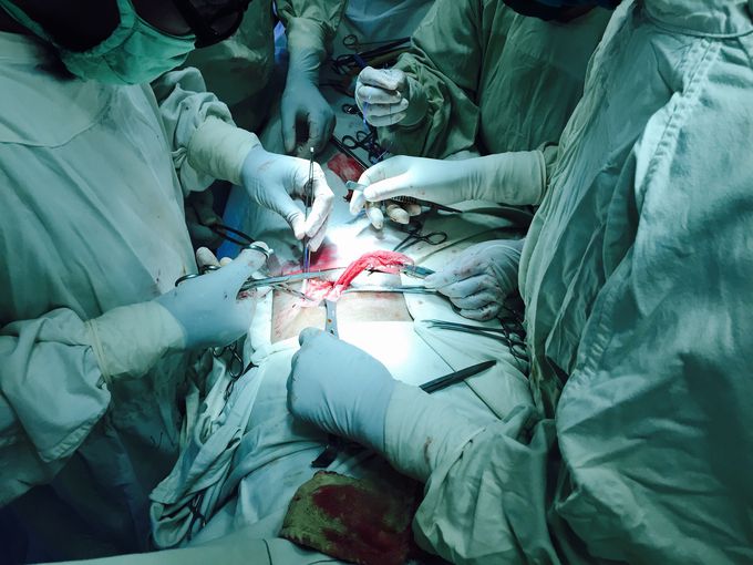 #herniotomy