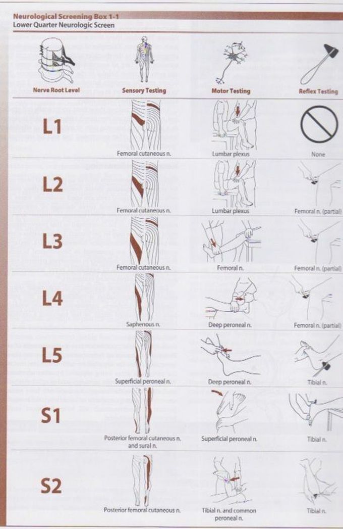 Nerve roots