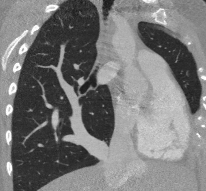 What is your diagnosis