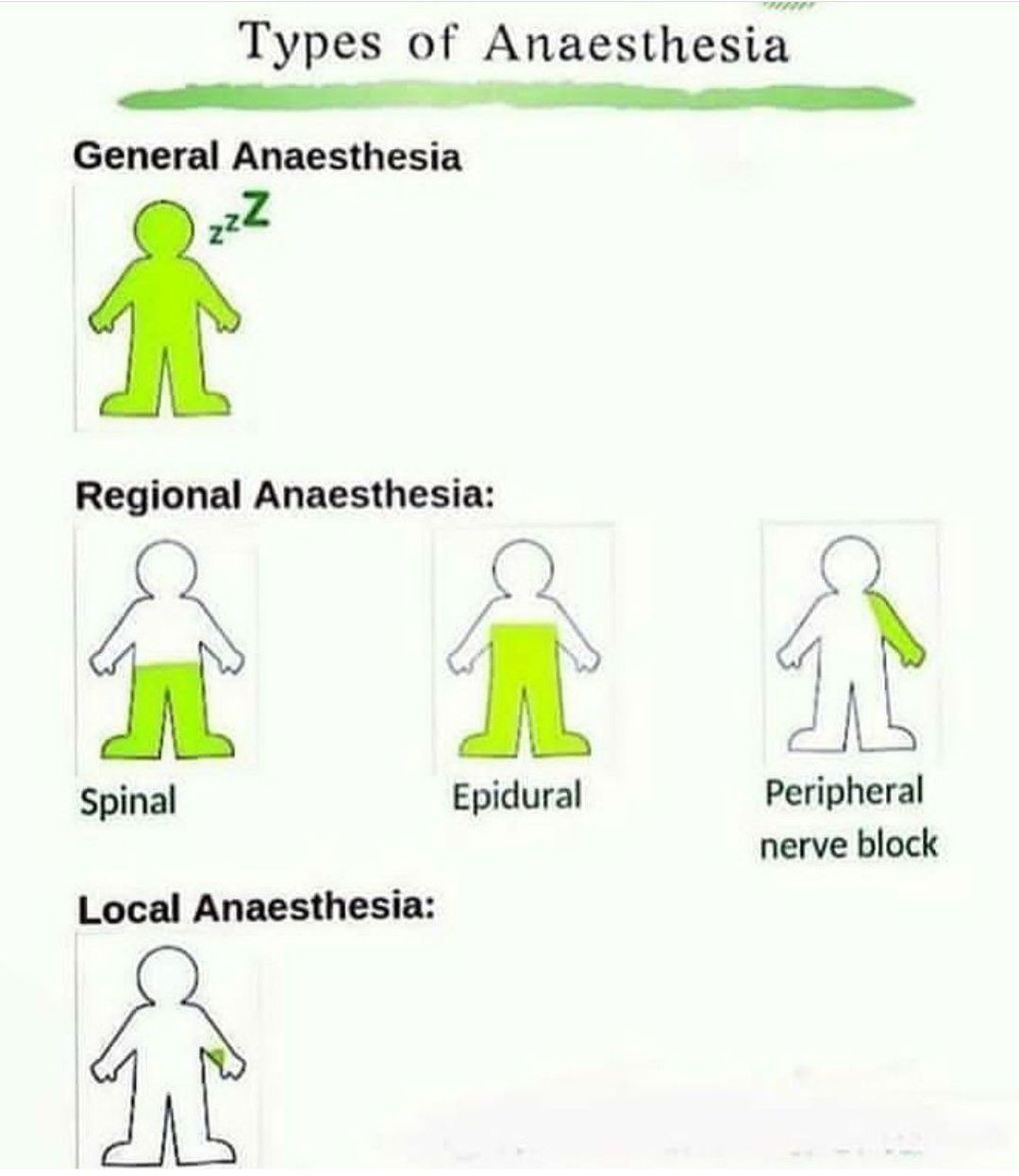 Types of anesthesia MEDizzy