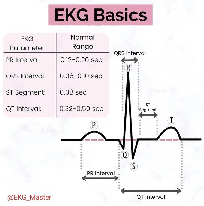 EKG Basics