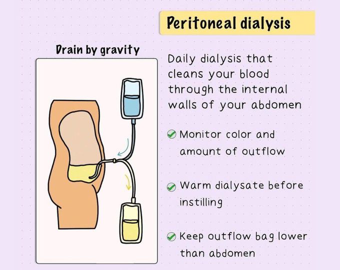 Peritoneal Dialysis