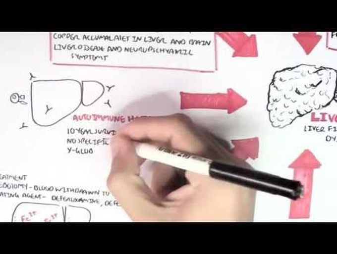 Liver Cirrhosis (Causes II)