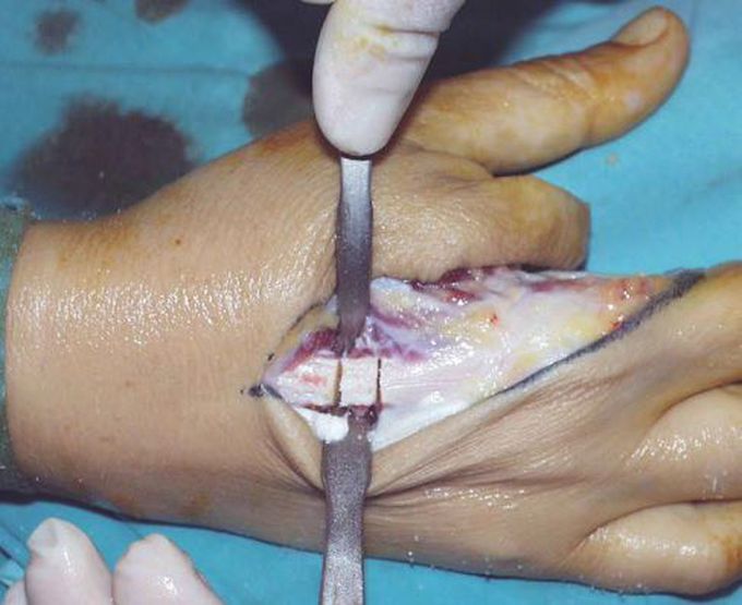Hand ot. See in tandan