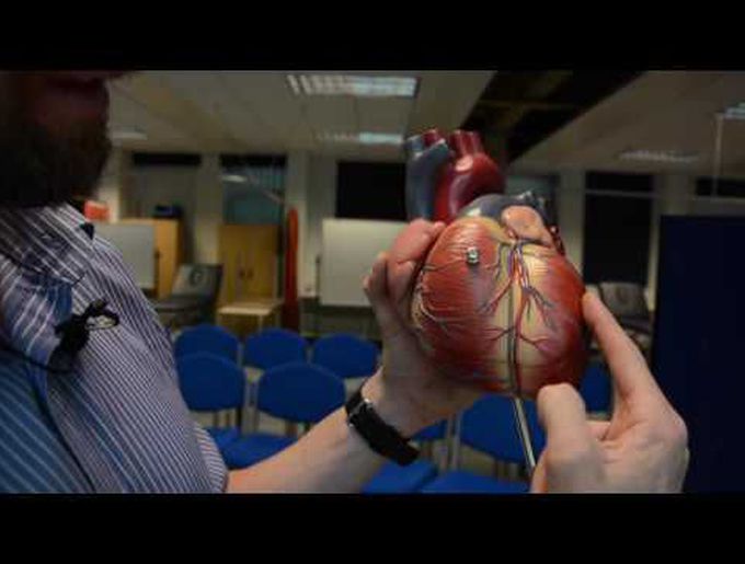 Coronary arteries & cardiac veins