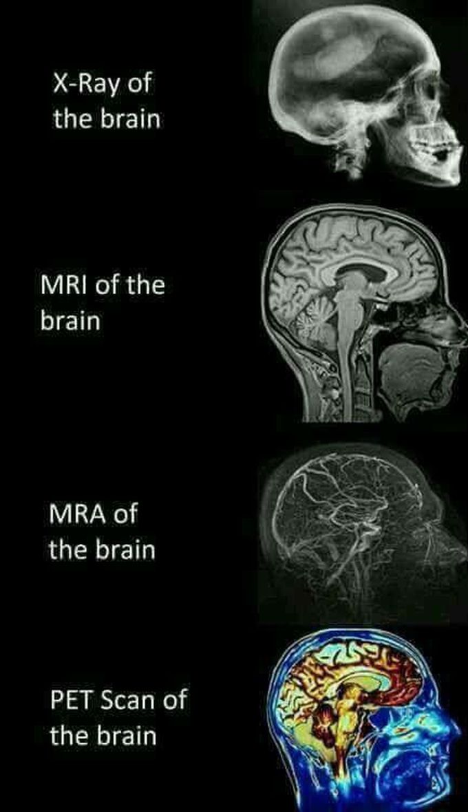 MEDizzy