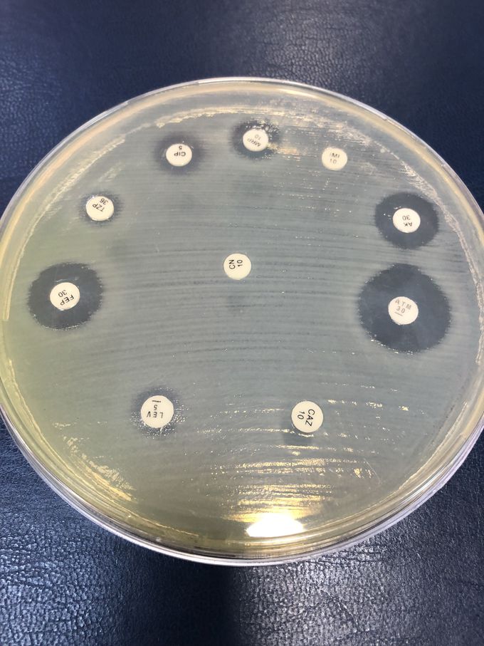 Examination of sputum, Pseudomonas aeruginosa, antibiotic sensitivity test.