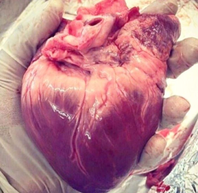 Heart...beautiful organ, right ?