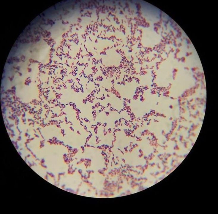 Кишечная палочка фото под микроскопом