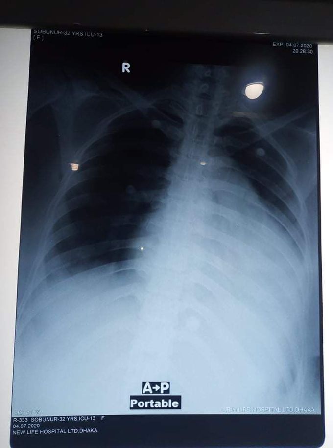 What is the diagnosis? Please explain in detail. It's very urgent