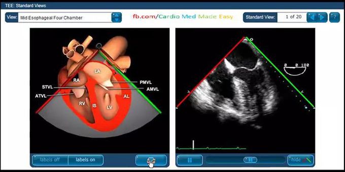 Transesophageal echo views