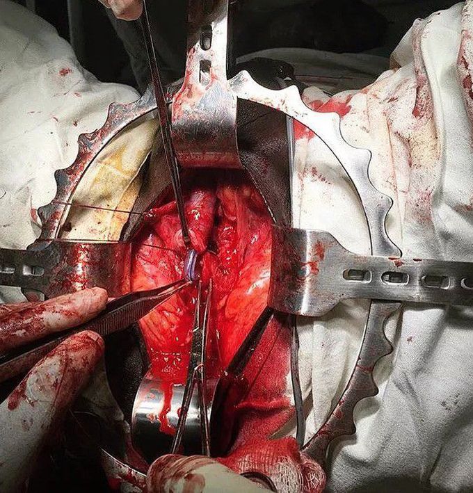 general surgery