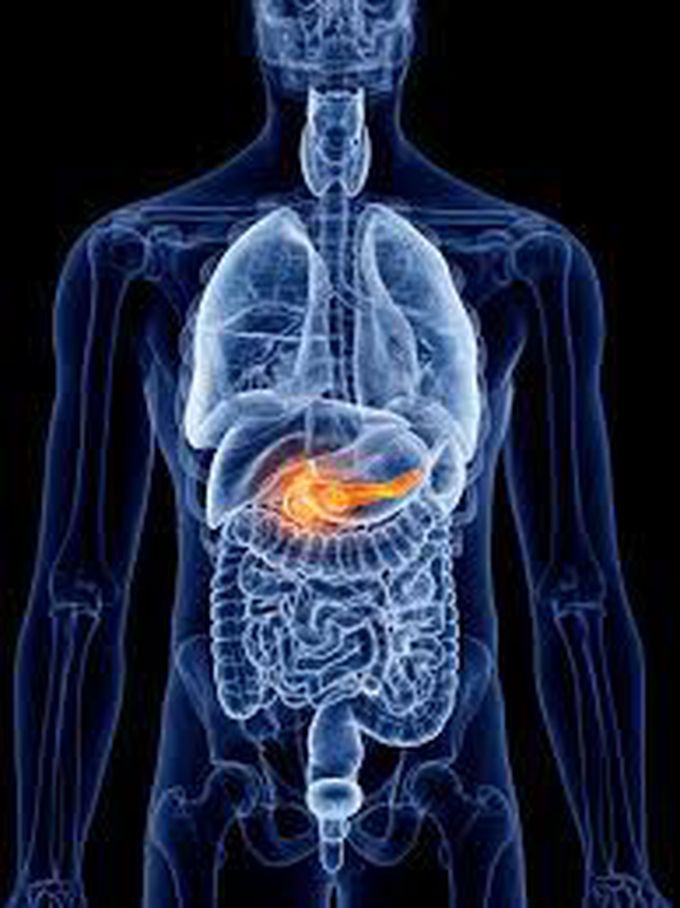 What is pancreatitis