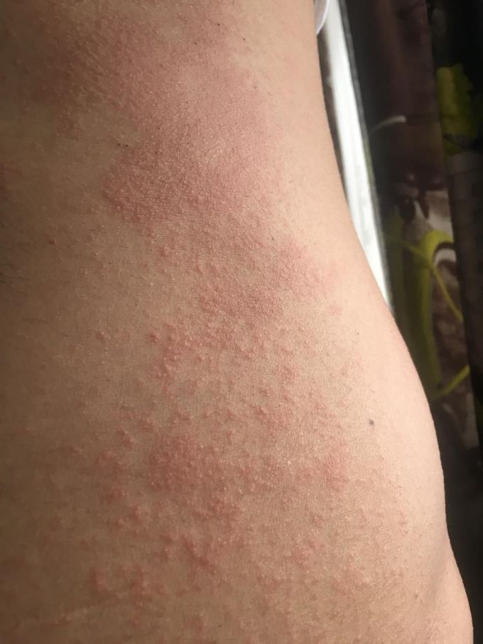 Help diagnose
