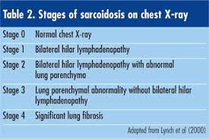 Sarcodosis- Stages