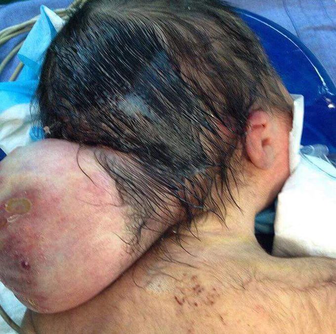 diagnosis??