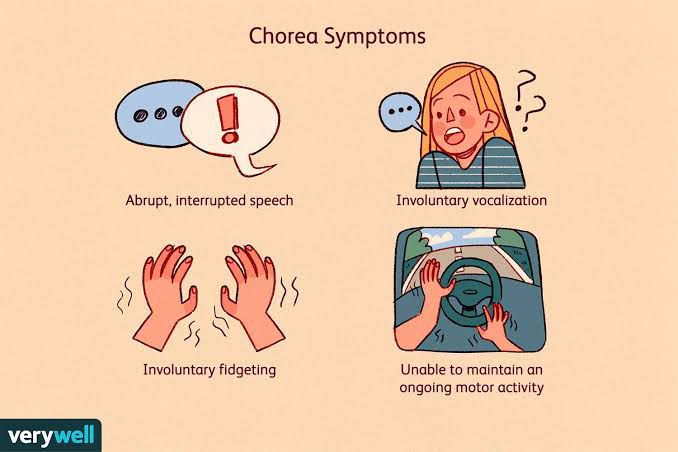 symptoms-of-chorea-gravidarum-medizzy