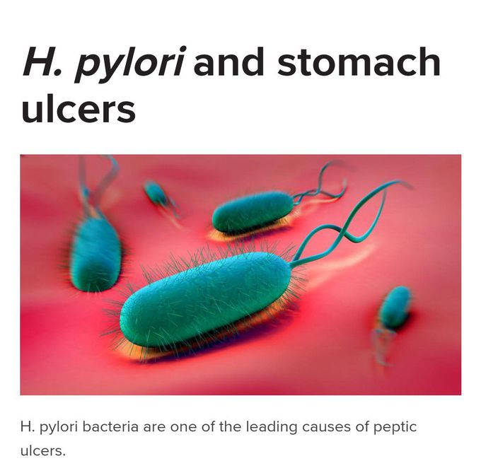 50% of population have Helicobacter pylori bacteria.