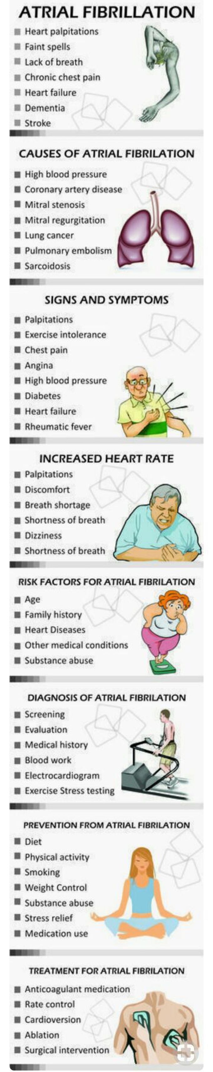 Atrial fibrillation