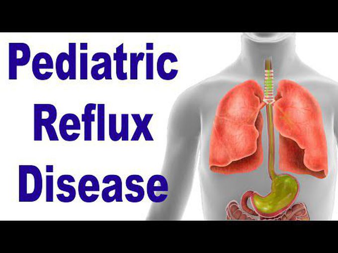 Pediatric Reflux: Causes and Symptoms