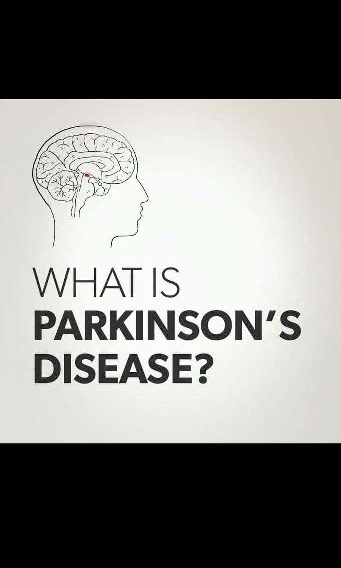 Introduction to Parkinsonism.