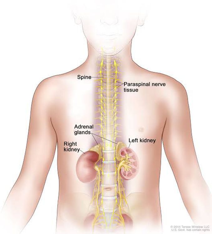 Neuroblastoma - MEDizzy