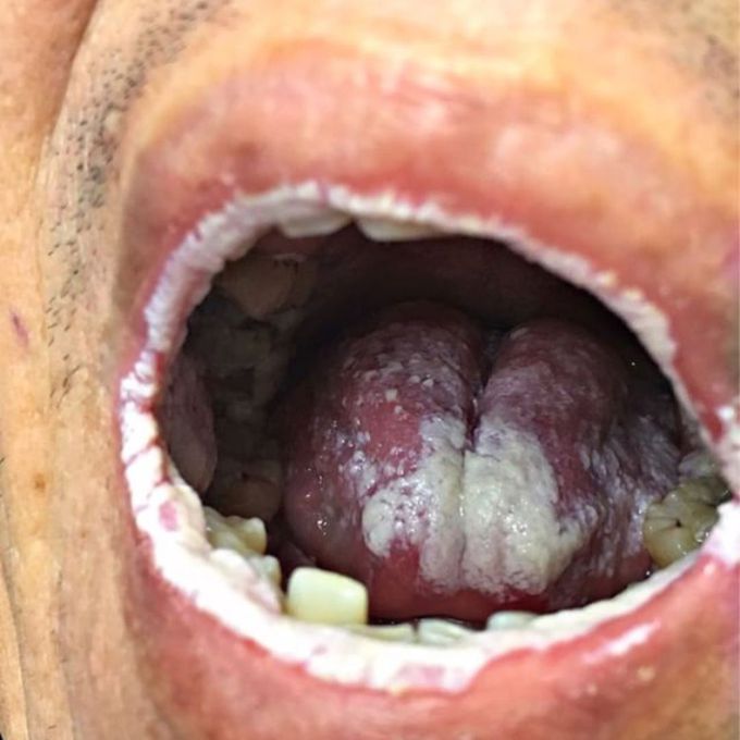 Diagnose???
