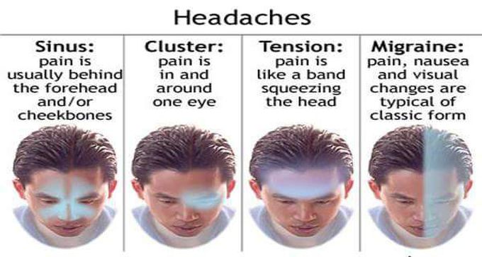 Types Of Headache - Medizzy