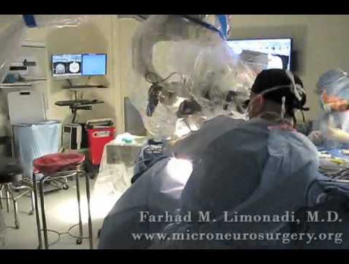Surgical Removal Pituitary Tumor Macroadenoma