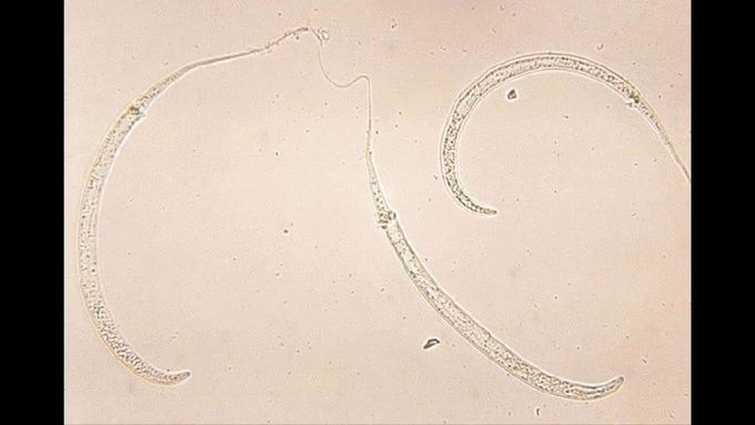 Dracunculus medinensis