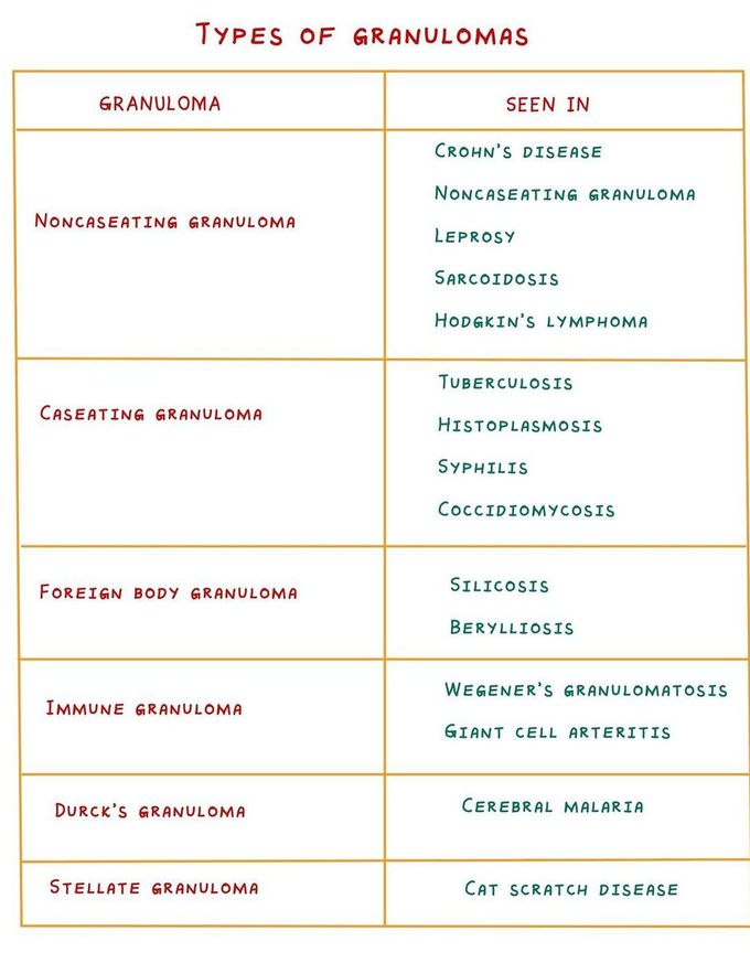 Types of Granulomas