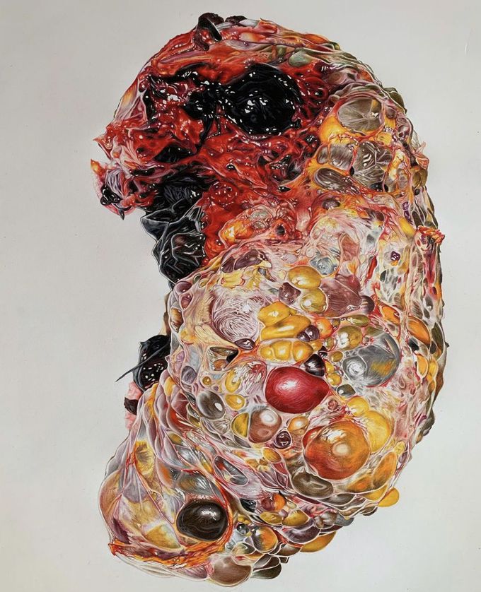 Hyper-realistic pencil illustration of a polycystic kidney