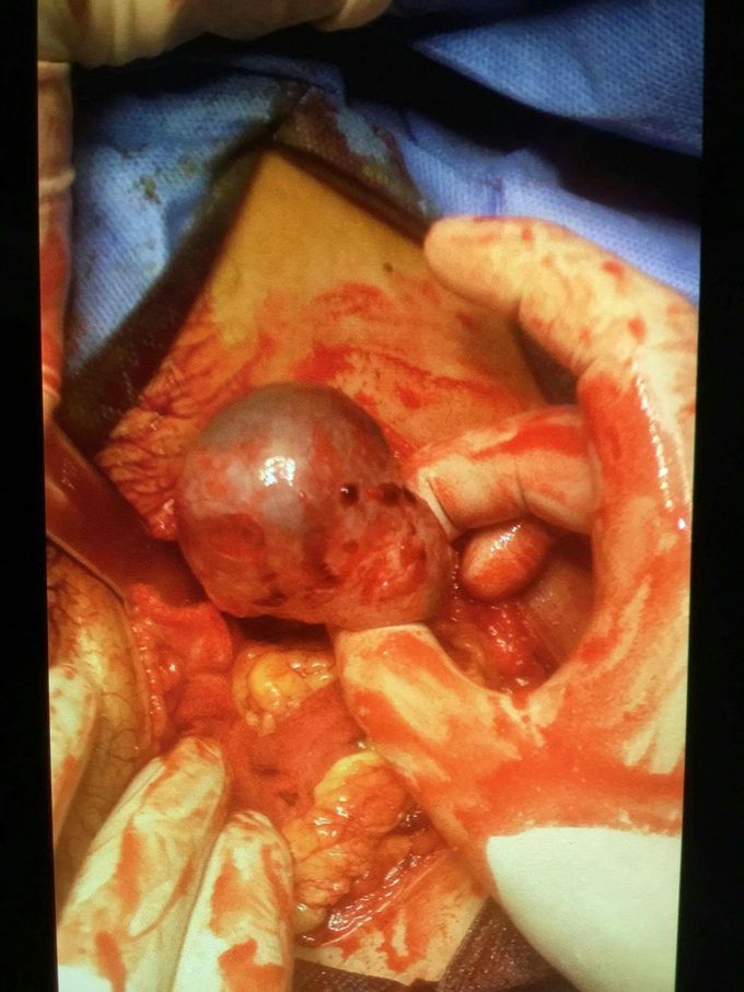 What's your diagnosis??? 