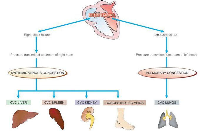 chronic venous congestion