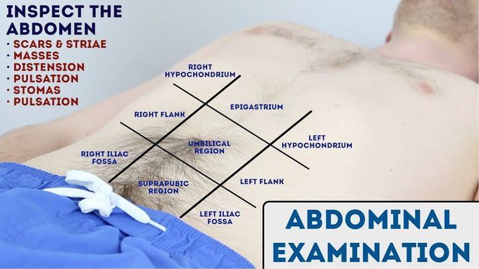 Abdominal Examination - OSCE Guide (New Release)