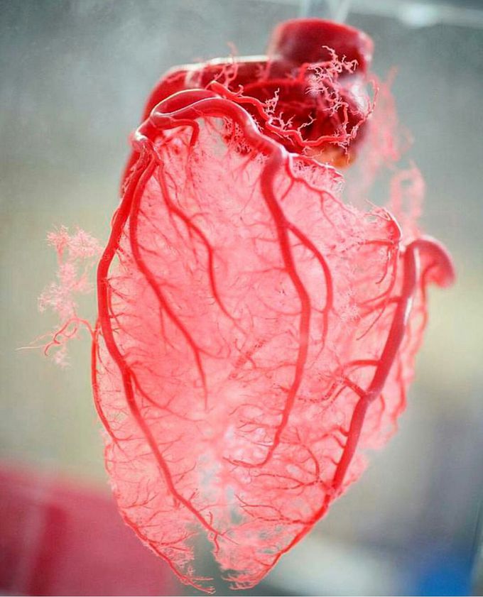 Resin cast of human heart blood vessels!!!