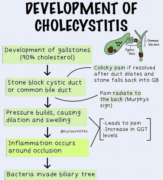 Development of Cholecystitis