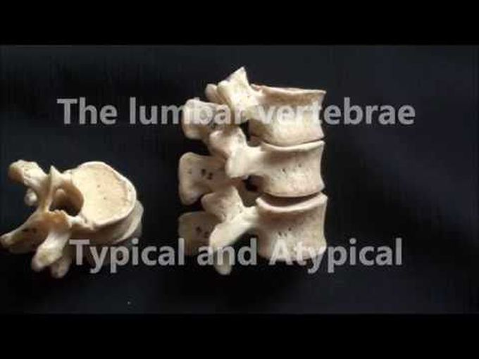 Lumbar Vertebrae- Gross Anatomy