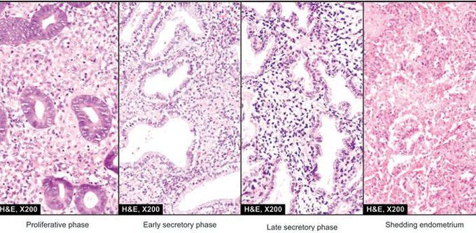 Endometrium