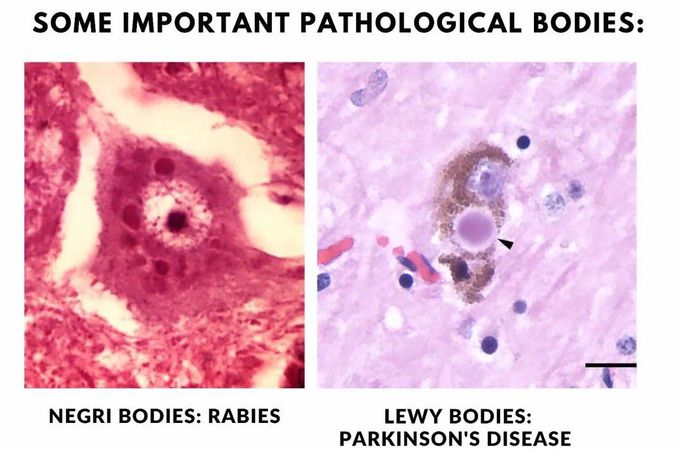 Pathology Bodies