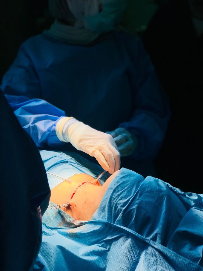 Thyroidectomy