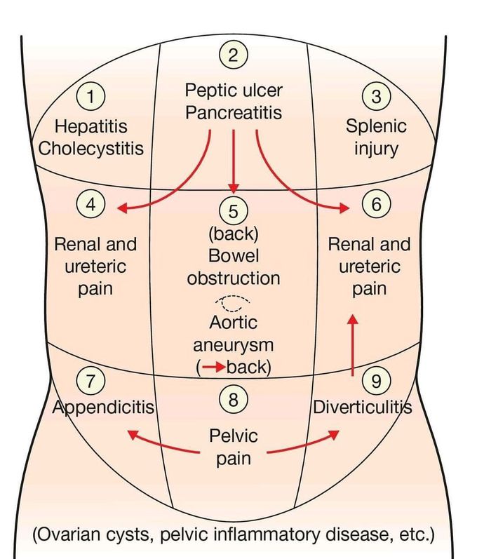 Pain associated with different abdominal regions