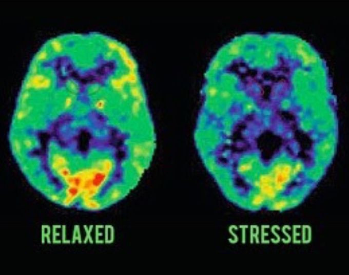 Relaxed vs. Stressed brain