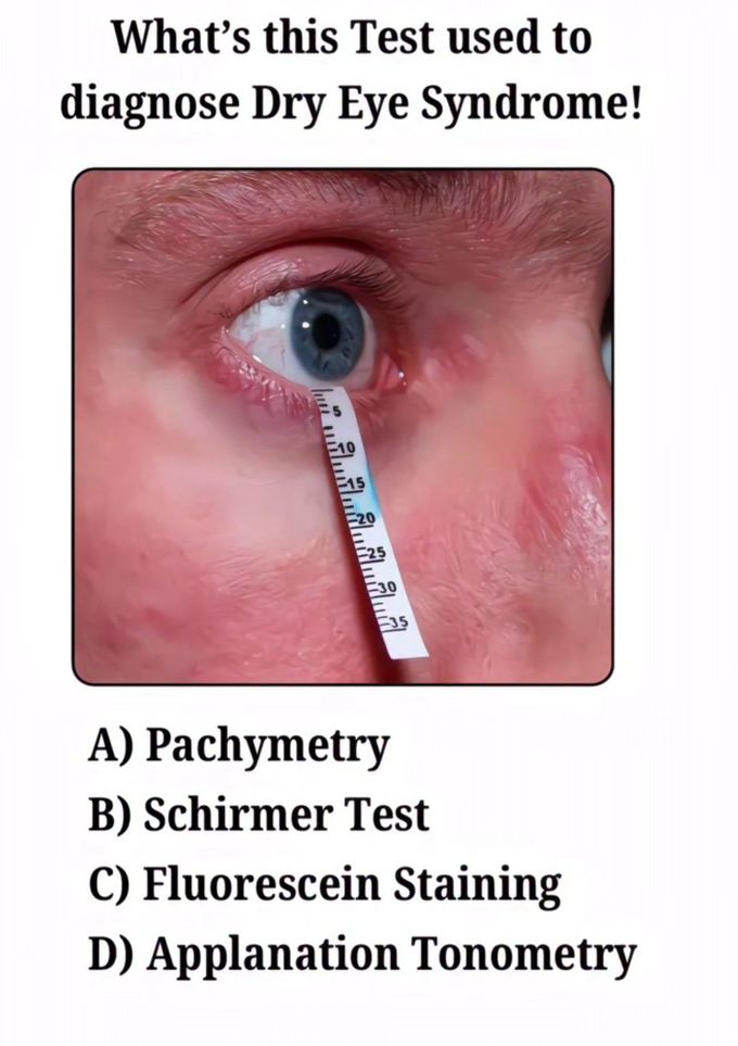 Identify the Test