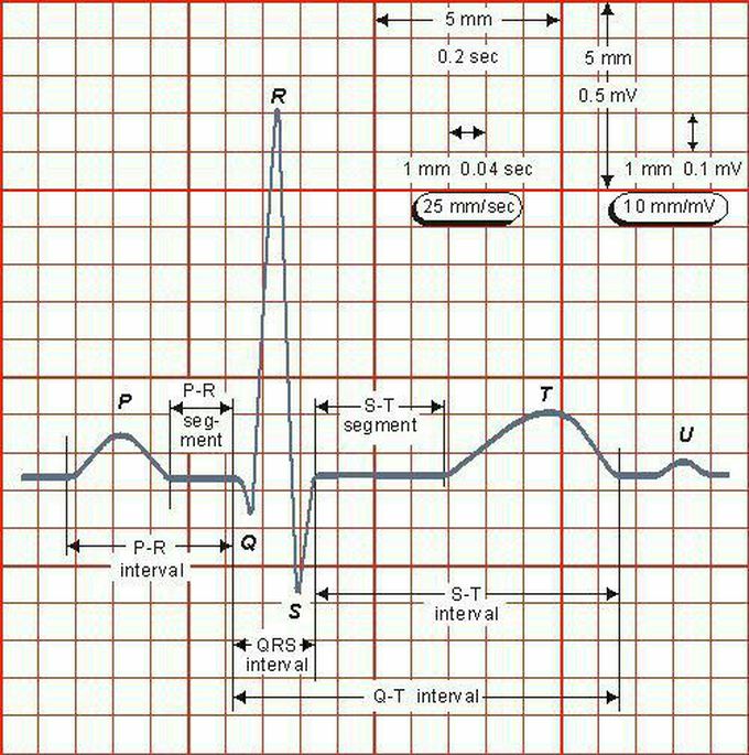 ECG wave