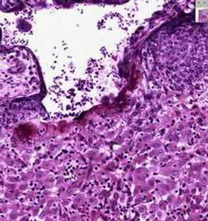 Histology- Placenta