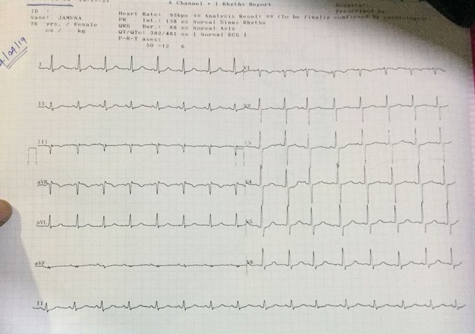 low-potassium-medizzy