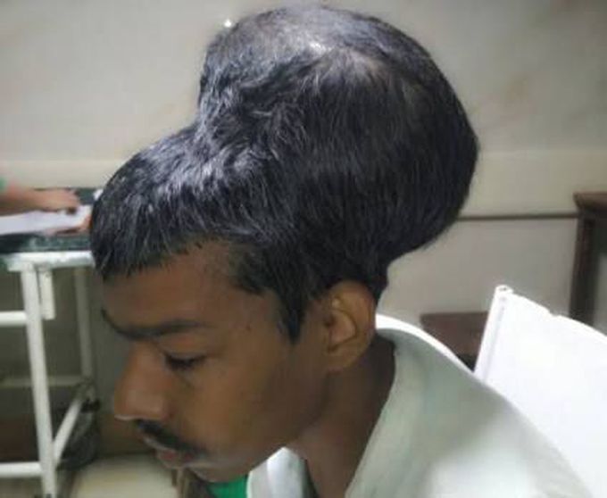 What is diagnosis this condition of brain?